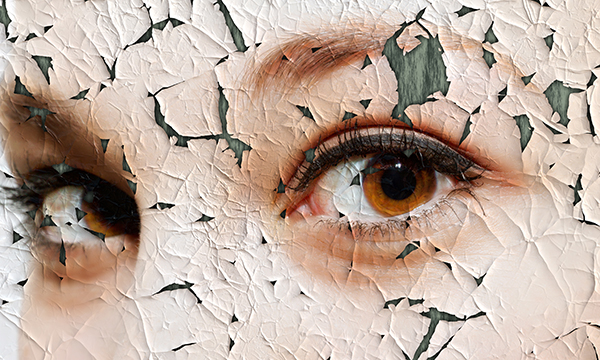 grey skin visible through breaks in young skin