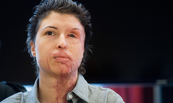 Well-being, physical and mental health: part 2. Responding to trauma