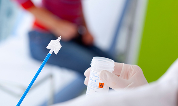 smear test kit