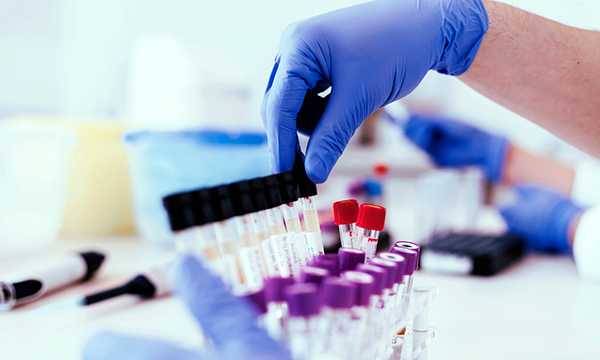 Test tubes in lab. Photo:  iStock