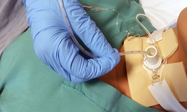 Tracheostomy care in community settings
