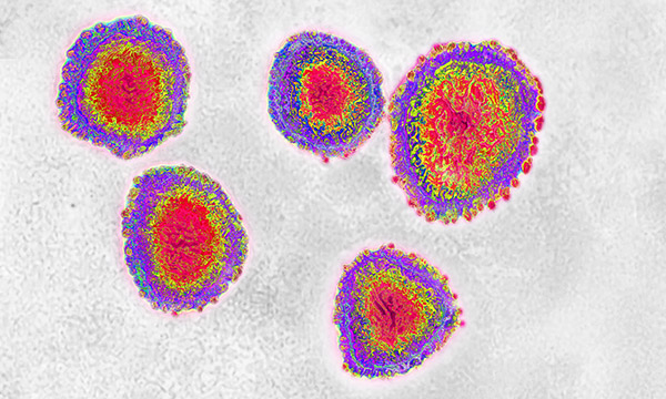 Coronavirus under the microscope