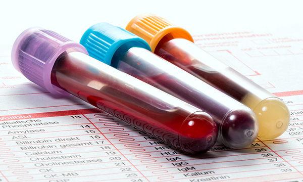 Rhabdomyolysis: a case-based critical reflection on its causes and diagnosis