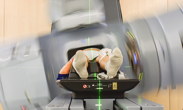 Assessing and managing diarrhoea in patients with prostate cancer who undergo pelvic radiotherapy