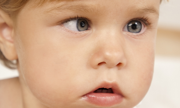 Picture shows the face on an infant