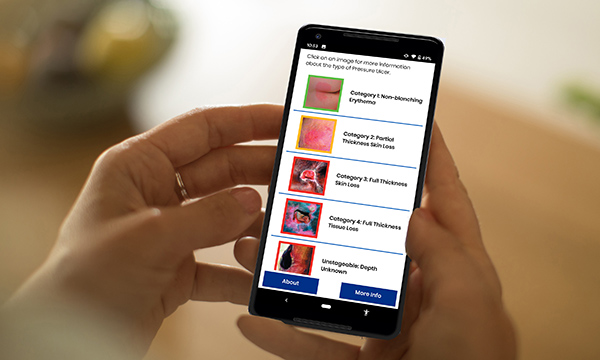 Wound app on a mobile phone for carers and care home workers to help identify and treat pressure ulcers