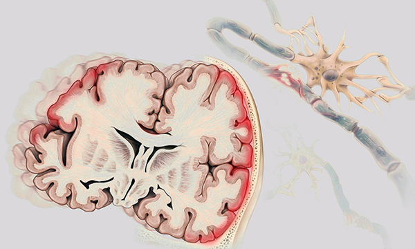 Undertaking a systematic assessment of patients with a traumatic brain injury