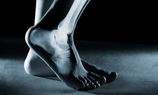 Assessment and management of metastatic bone cancer in emergency departments