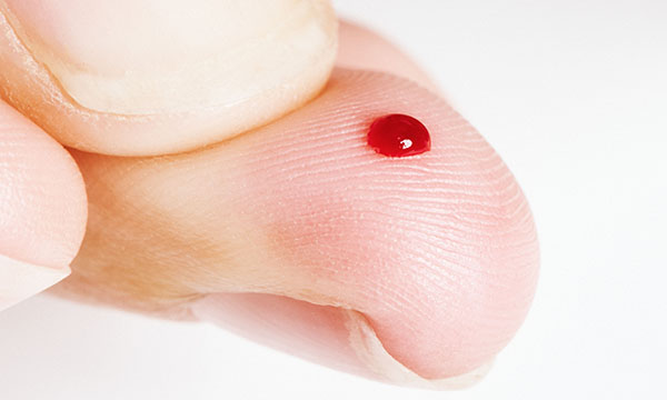 Sharps injuries can be seen as part of the job in nursing, despite their risk to safety and the mental well-being of staff