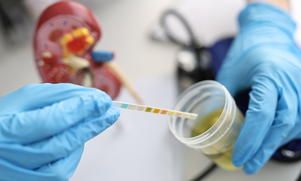 Chronic kidney disease: understanding its association with other long-term conditions