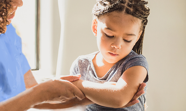 Bowing fractures of the forearm in children