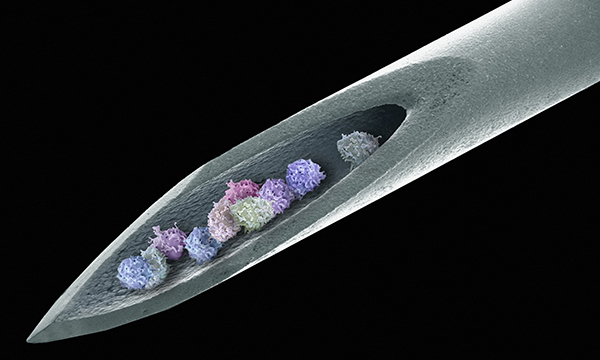 Haematopoietic stem cell transplantation: an audit of late effects on patients