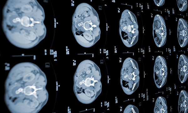 CAT scan of the human abdomen