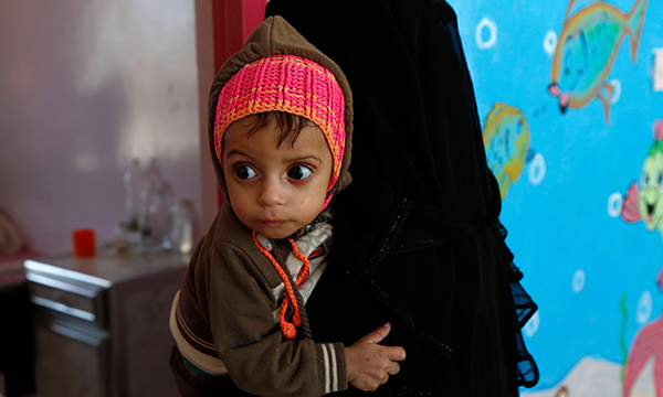 Exploring risk factors for undernutrition in children aged under five years in Yemen