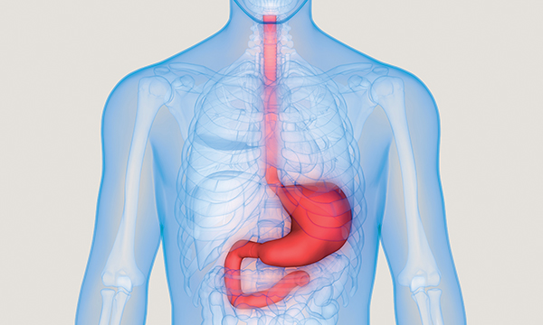 Upper gastrointestinal (GI) bleed: illustration of human anatomy showing the route a GI bleed takes 