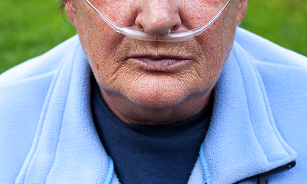 chronic obstructive pulmonary disease