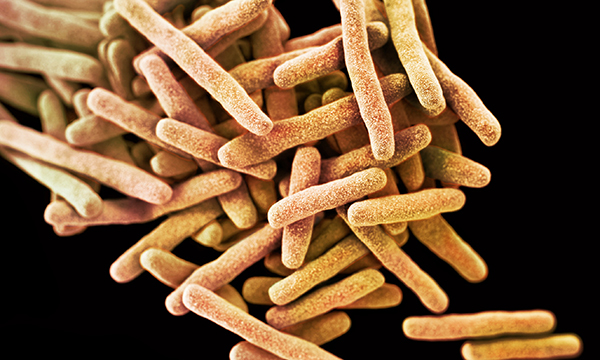 Drug-resistant_tuberculosis_bacteria-SPL.jpg