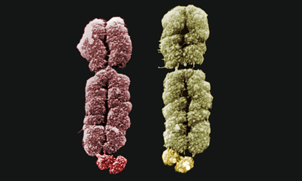 Fragile X chromosomes