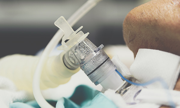 Mechanical ventilation