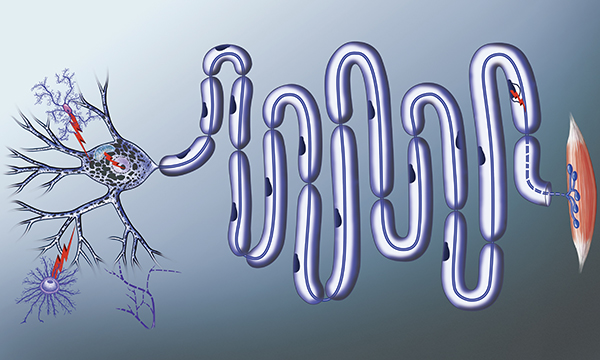 Motor_Neurone_Disease