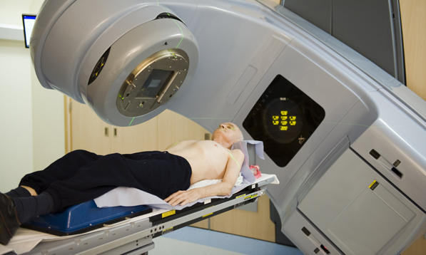 Radiotherapy