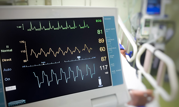 Understanding errors