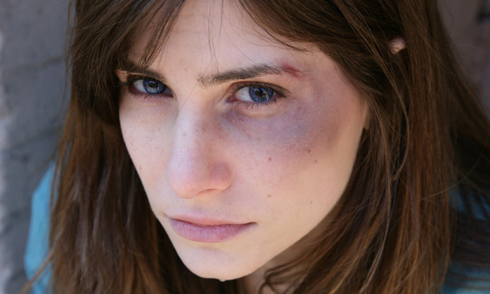 Violence against NHS staff