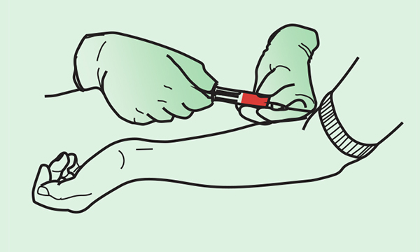 Image of a blood sample being taken from an arm
