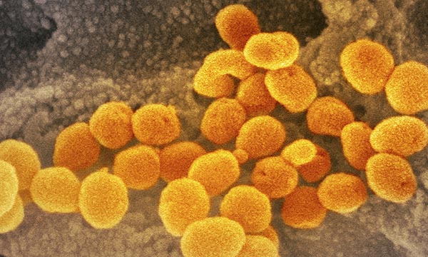 Covid-19 coronavirus particles. The NMC says it will consider context for fitness to practise cases that relate to care given during a possible widespread coronavirus outbreak