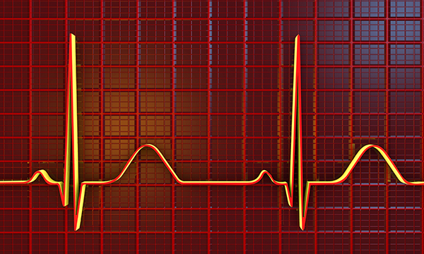 Implementing vernakalant: a novel approach to cardioversion