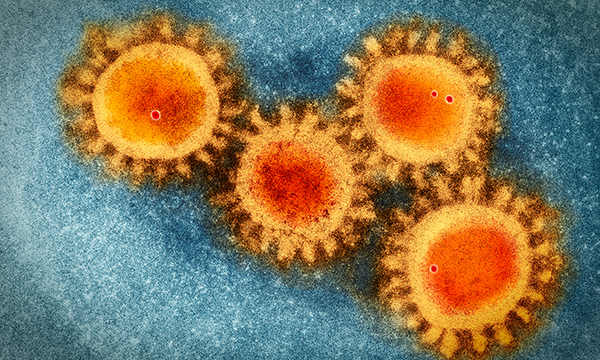 Providing optimal nutritional care to patients with long-COVID