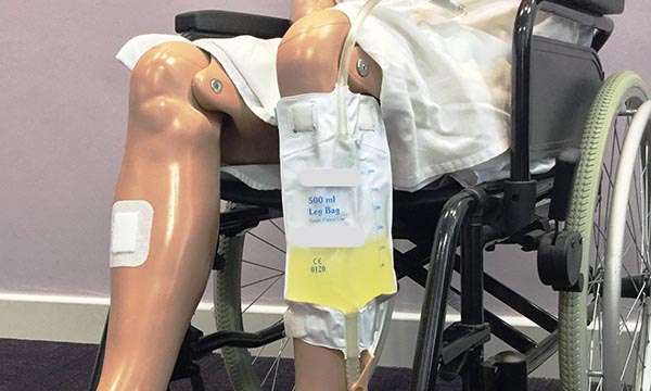 Management of indwelling urinary catheters for people with learning disabilities