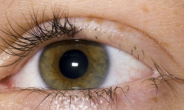 Psychodermatology: assessment, treatment and management