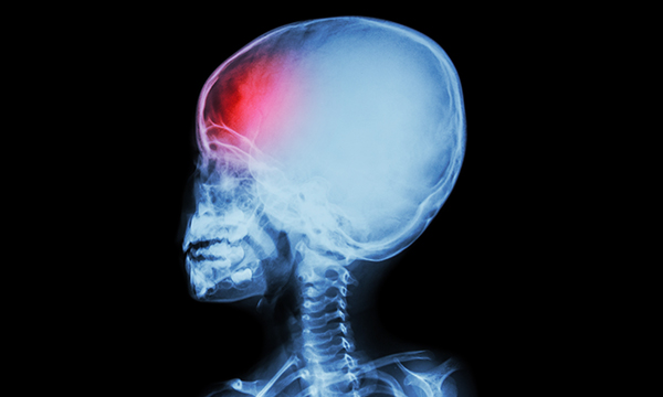 Neurological observations in infants, children and young people: part one