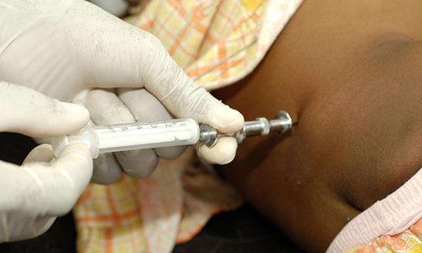 The nurse’s role in assisting with a lumbar puncture in an infant or child