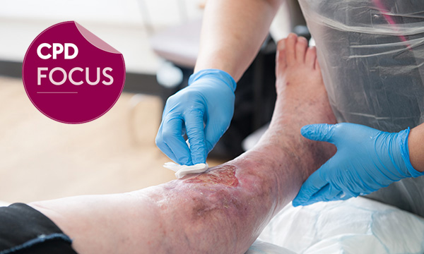 CPD focus: a critical examination of five common wound care myths 