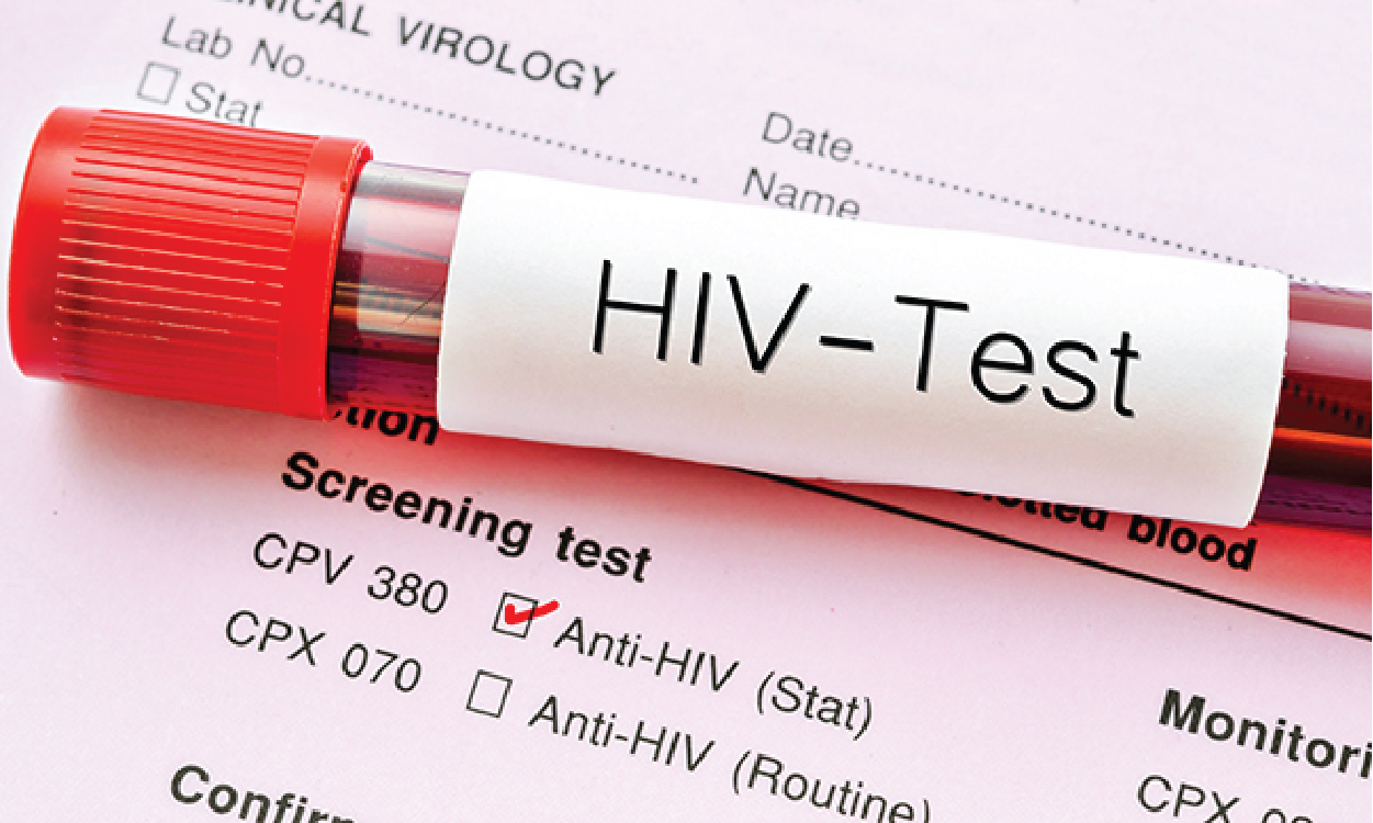 Current approaches to HIV prevention, treatment and care