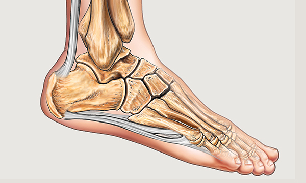 Heel pressure ulcers: understanding why they develop and how to prevent them