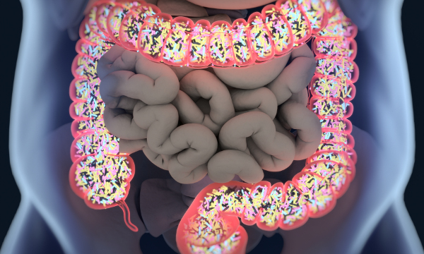 Improving outcomes for patients with irritable bowel syndrome in primary care, with specific focus on diet