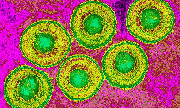 Varicella zoster virus 
