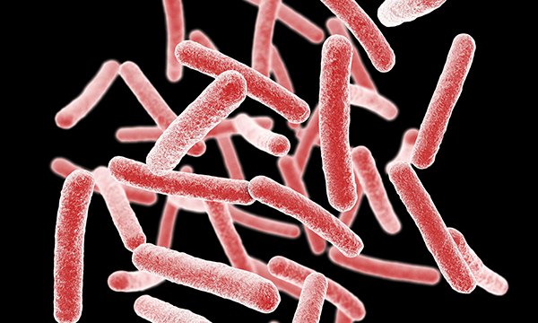 Recognising and managing non-tuberculous mycobacterial pulmonary disease