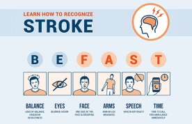 A poster showing how to recognise a potential posterior stroke by using the acronym BEFAST