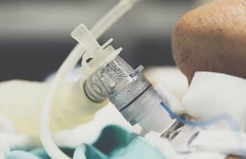 Mechanical ventilation