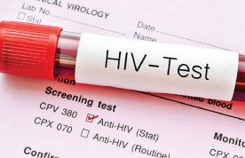 Current approaches to HIV prevention, treatment and care
