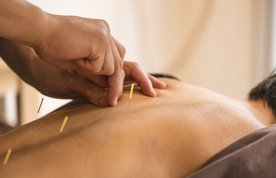 Use of acupuncture in the management of pain
