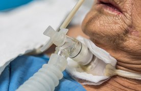 Care of the critically ill patient with a tracheostomy