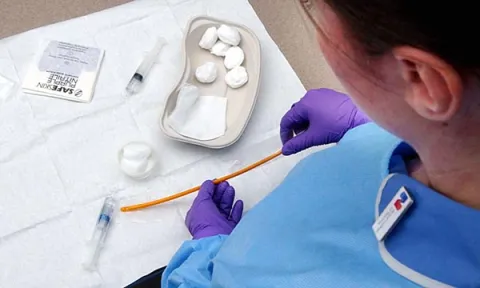 nurse prepares a catheter for insertion
