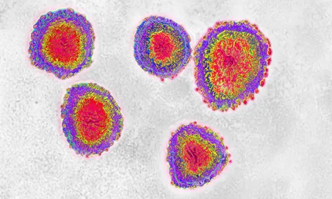 Coronavirus under the microscope
