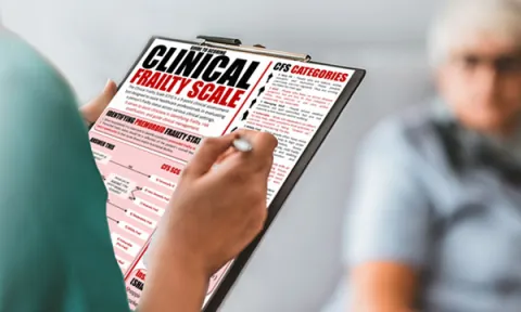 Nurse using a Clinical Frailty Scale