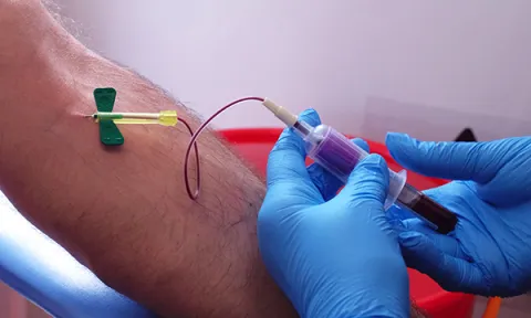 A nurse wearing disposable gloves inserts a needle into a patient’s arm to take a sample of blood